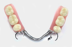 A partial denture laying on a surface